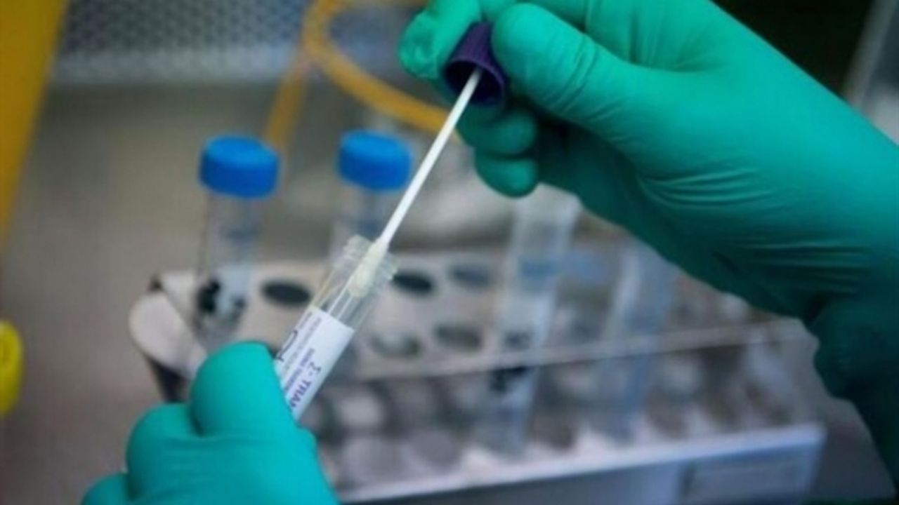 7 bin 666 test, 22 pozitif vaka