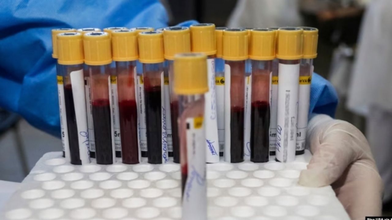 Türk bilim adamından kanser teşhisinde çığır açacak çalışma